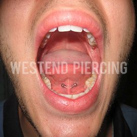 Nyelvfék piercing​